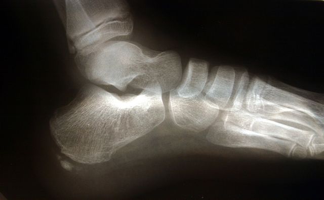 wrightpachiropodists_12